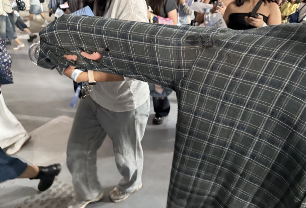 Burn injuries from SEVENTEEN concert