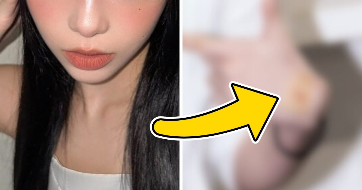 SM Entertainment Star's Shocking Bruises Trigger Concern