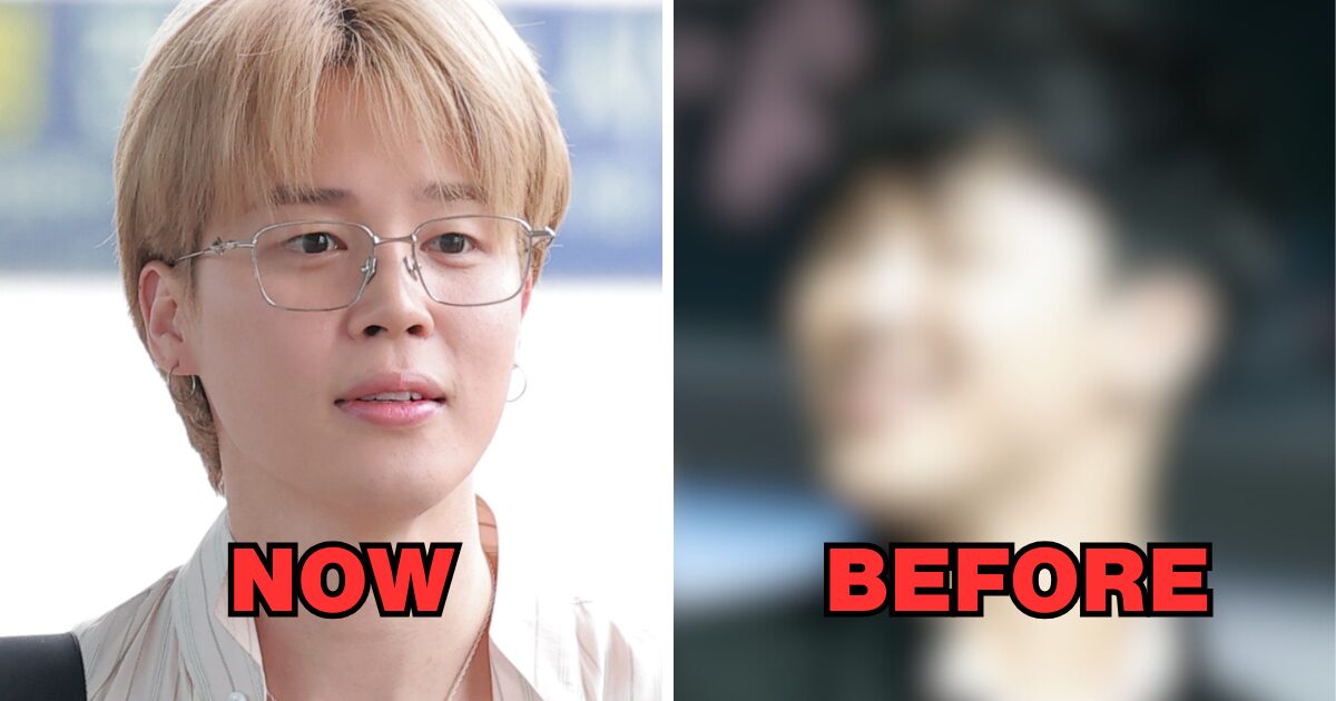 Jimin with alleged surgery comparison