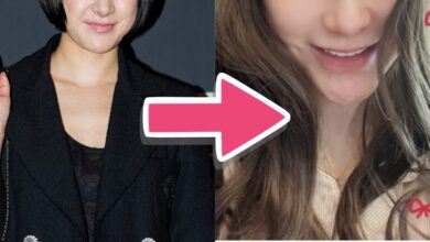 Seo In Young before and after nose implant removal