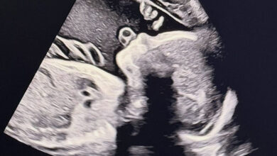 Song Seunghyun baby announcement