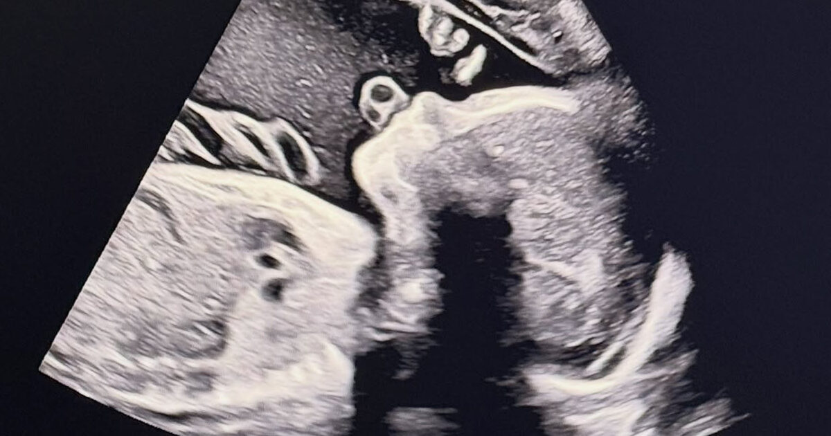 Song Seunghyun baby announcement