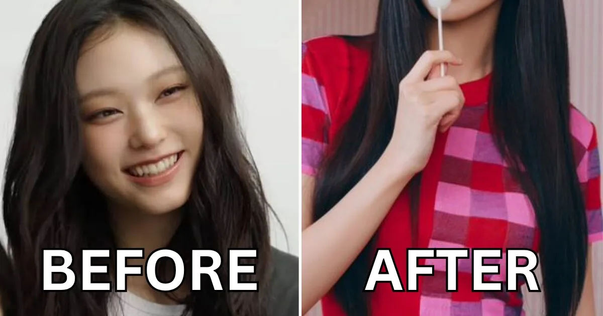 NewJeans' Haerin suspected of getting veneers after comeback photos