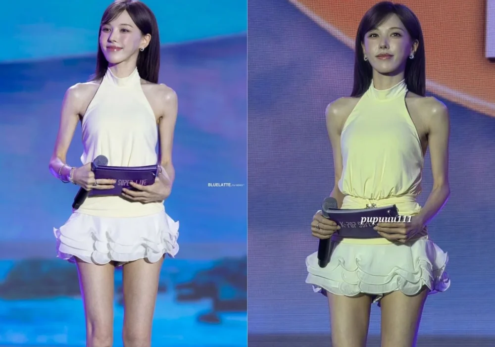 Red Velvet's Wendy appears extremely thin, prompting fan health concerns